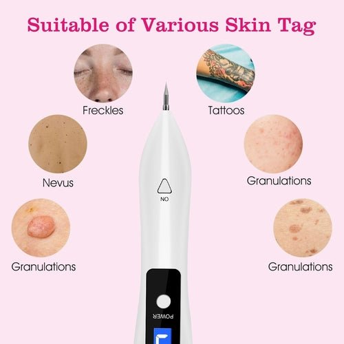 Skin Tag Repair Kit Portable Beauty Equipment Multi - Level with Home - UrbanNest Co