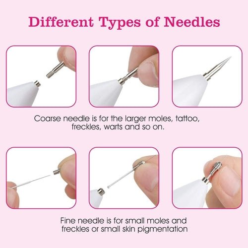 Skin Tag Repair Kit Portable Beauty Equipment Multi - Level with Home - UrbanNest Co